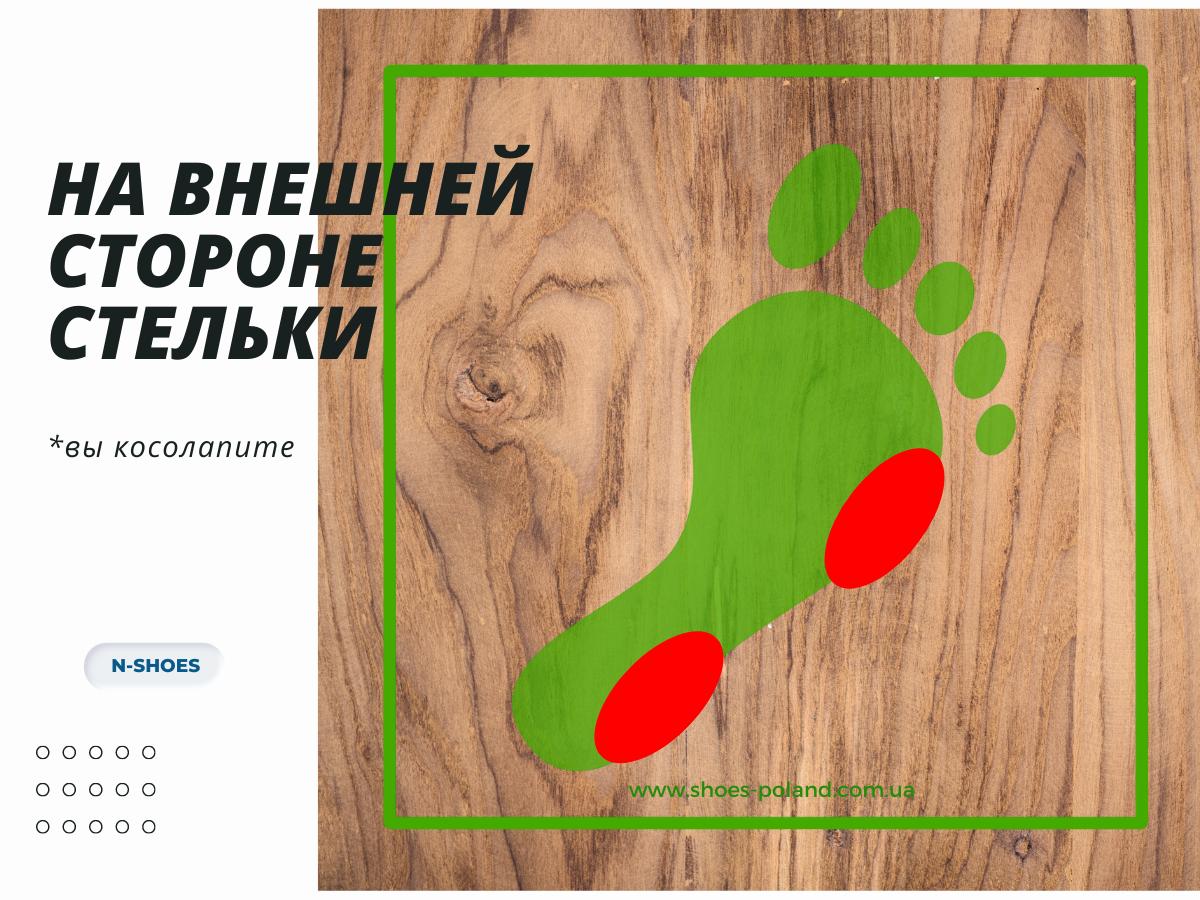 что означает износ обуви на внешней стороне стельки