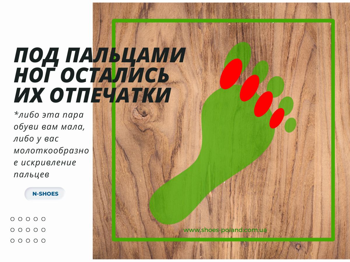 что означает износ обуви под пальцами ног остались их отпечатки