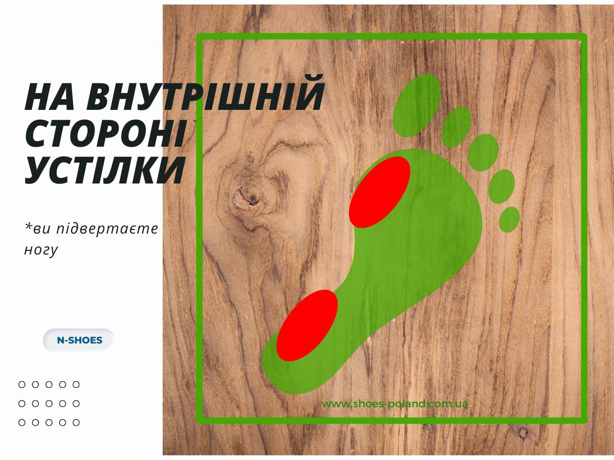 що означає знос взуття на внутрішній стороні устілки