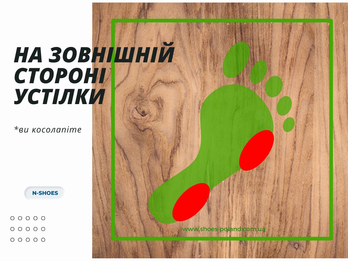 що означає знос взуття на зовнішній стороні устілки