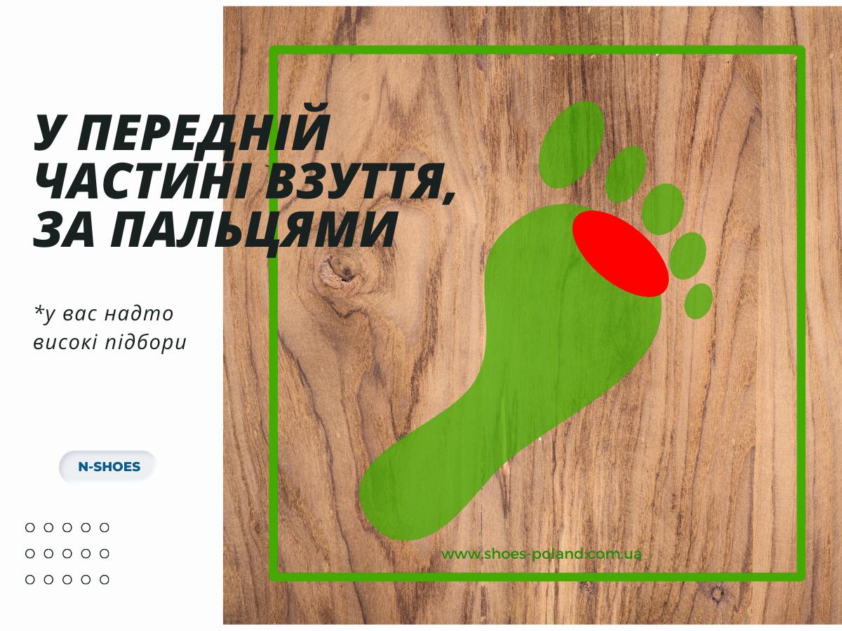 що означає зношування взуття в передній частині взуття, за пальцями