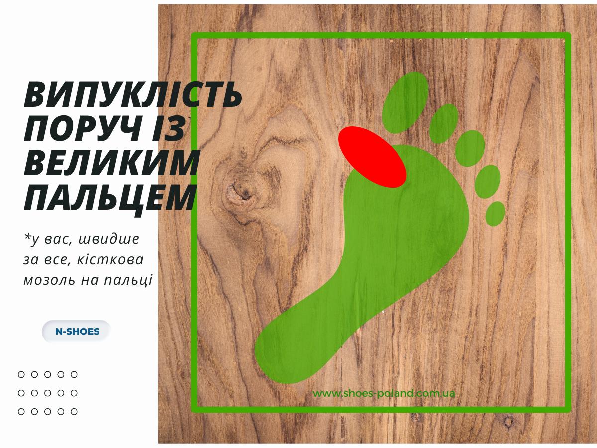 що означає знос взуття випуклість поруч із великим пальцем