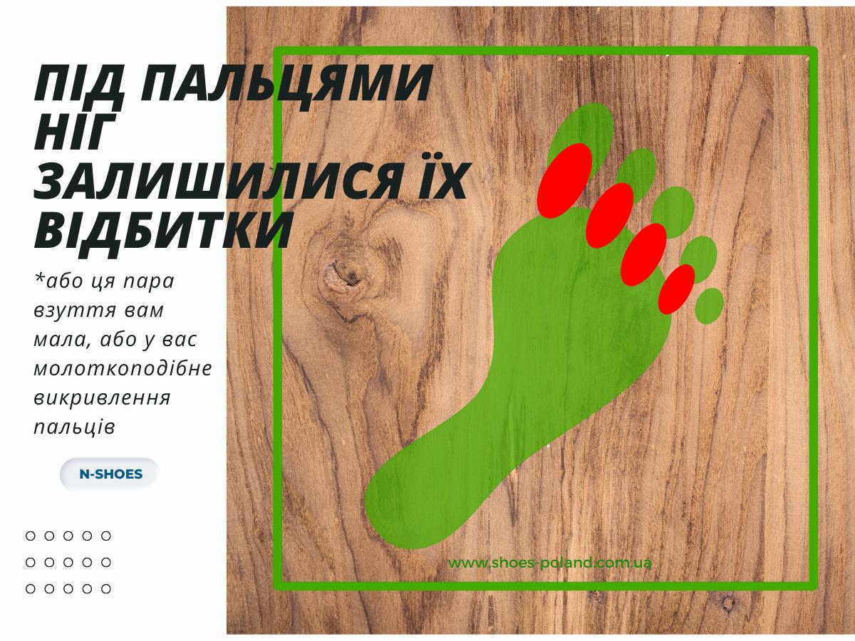що означає знос взуття під пальцями ніг залишилися їхні відбитки